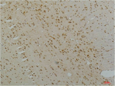 Immunohistochemical analysis of paraffin-embedded Rat Brain Tissue using Cav1. 2Rabbit pAb diluted at 1:200.